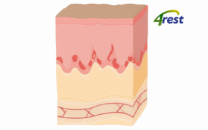 a diagram of a skin layerLàn da